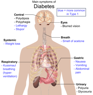 http://upload.wikimedia.org/wikipedia/commons/thumb/2/28/Main_symptoms_of_diabetes.png/300px-Main_symptoms_of_diabetes.png